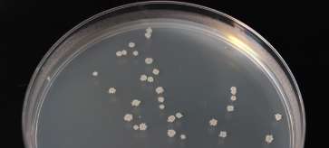 Istraživanja bakterijskih biofilmova...